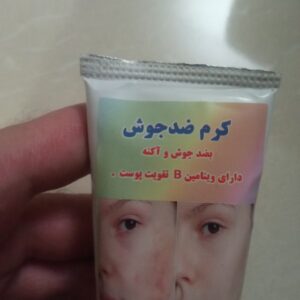 کرم ضد جوش