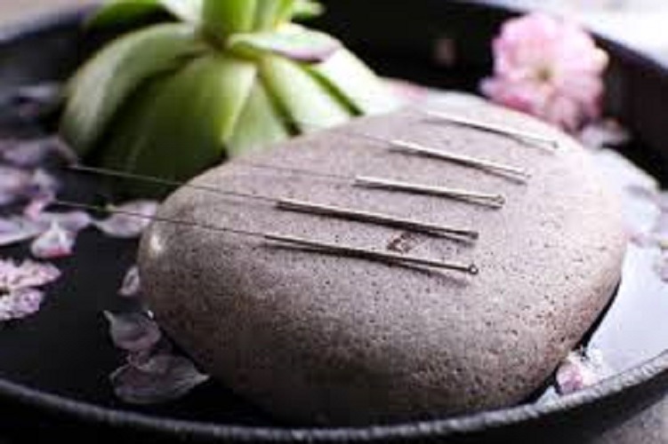 اموزش تخصصی طب سوزنی