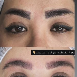 ریموابرو وخط چشم  تک جلسه ای باتضمین