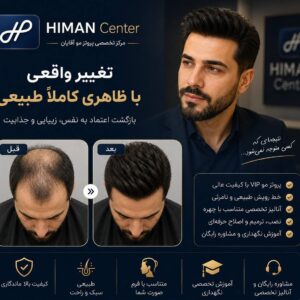 پروتز مو طبیعی در اصفهان | خط رویش کاملاً طبیعی + مشاوره رایگان