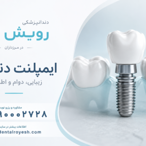 ایمپلنت کره ای